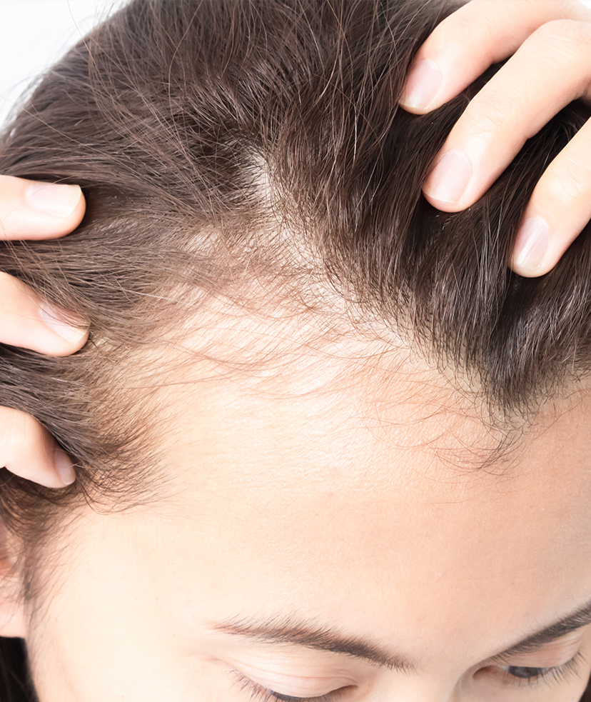 Photo of hair loss