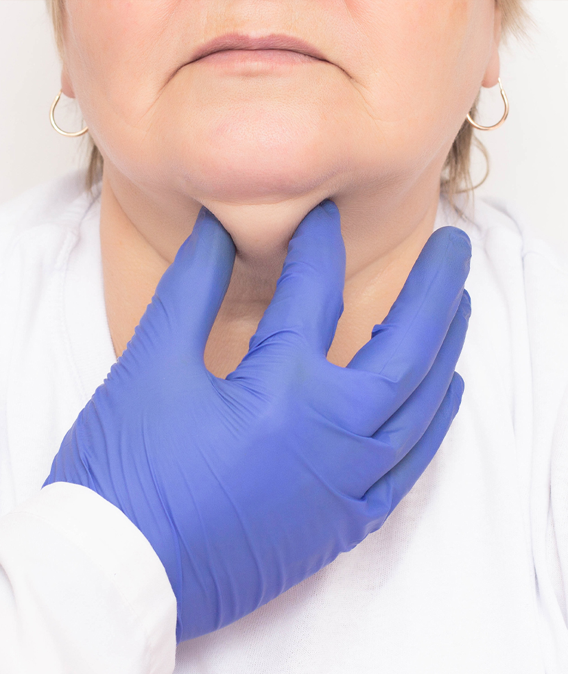 Photo of a woman's double chin